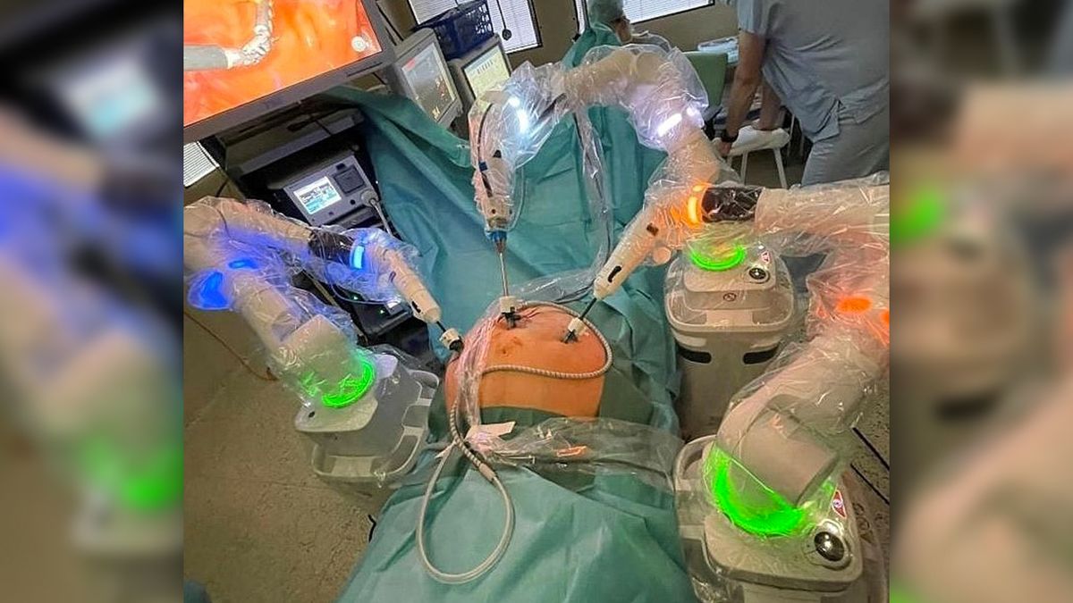 Nový chirurgický robot má za sebou v Brně několik úspěšných operací